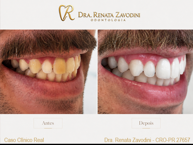 Odontologia estética
